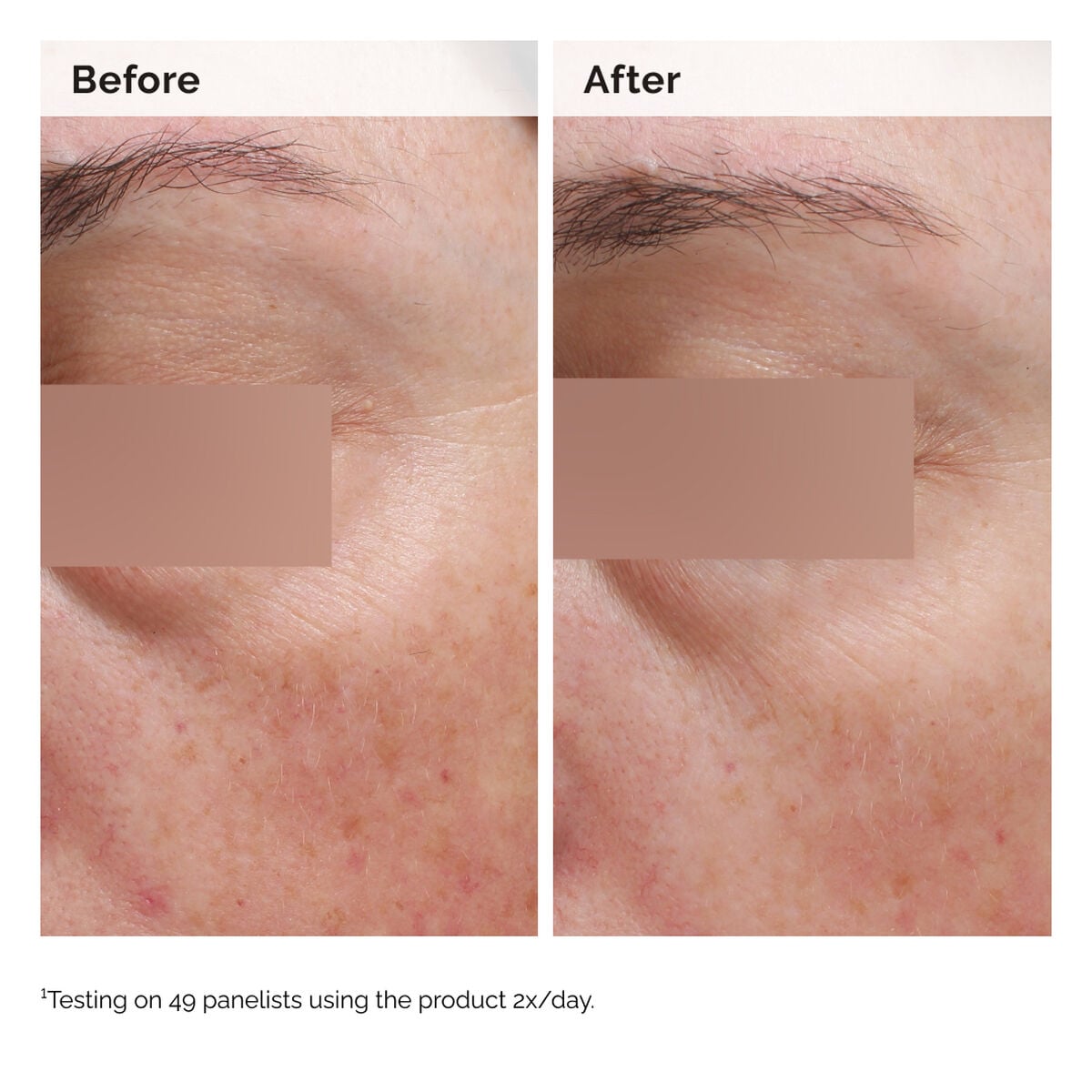 niacinamide-5-face-and-body-emulsion-s1 2024-08-23-ORD-Nia-5pct-Face-Body-B-A-Elasticity-Global-02-1x1.jpg