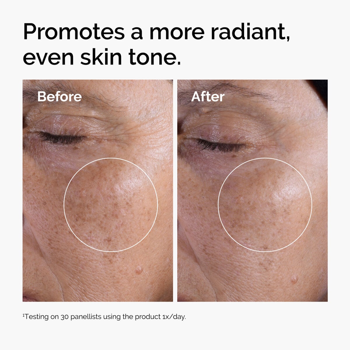 glycolic-acid-7-exfoliating-toner-p7 ord-glycolic-before-after-radiance.jpg