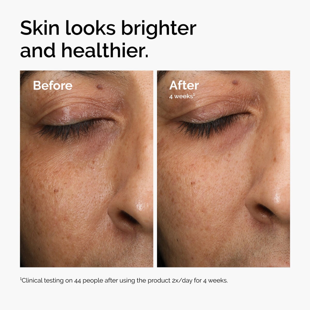 multi-antioxidant-radiance-serum-o9 ord-mars-before-after-healthy.jpg