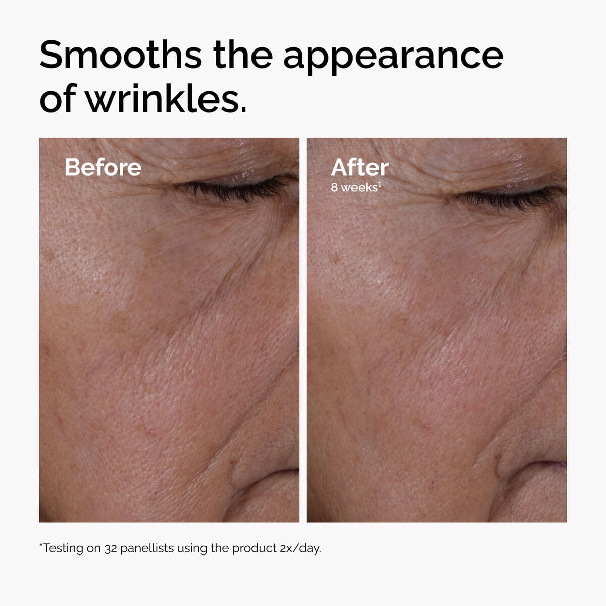 multi-peptide-ha-serum-i9 ord-multi-peptide-ha-serum-wrinkles-before-after.jpg