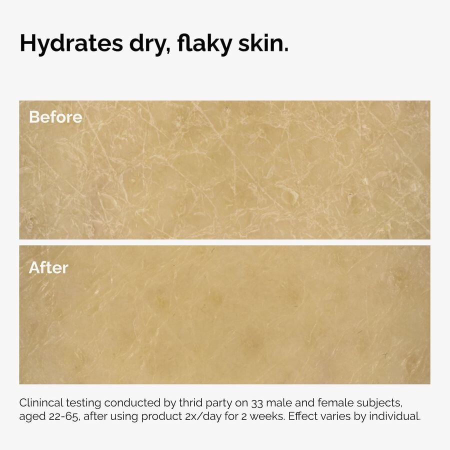 the-body-care-collection-s0 ord-natural-moisturizing-factors-inulin-body-before-after-graphic-02.jpg