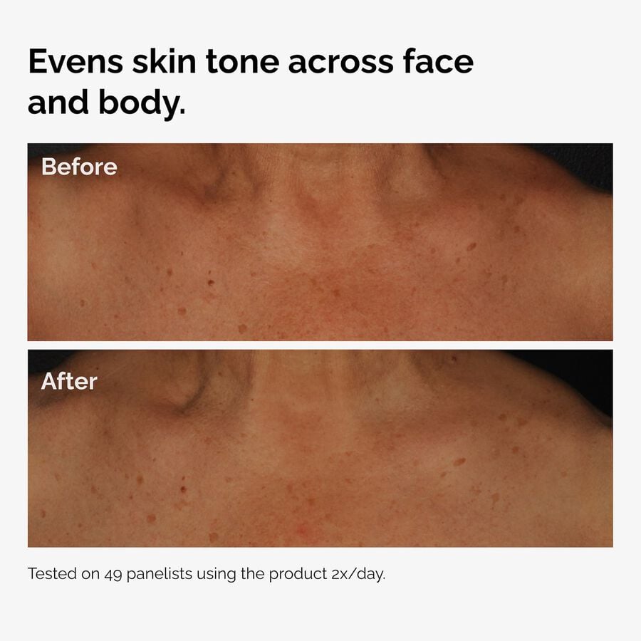 the-body-care-collection-s0 ord-niacinamide-face-body-serum-before-after-even-tone-graphic.jpg